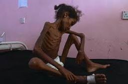 Meet Abrar, 12, who weighs just 28 pounds, a victim of our Yemen policy.